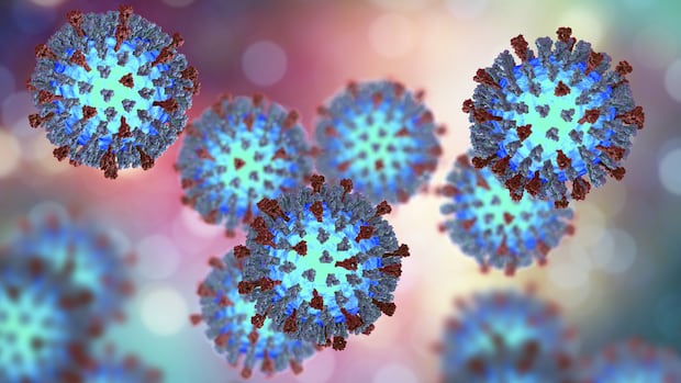 oph-warns-of-possible-measles-exposure-at-2-ottawa-churches