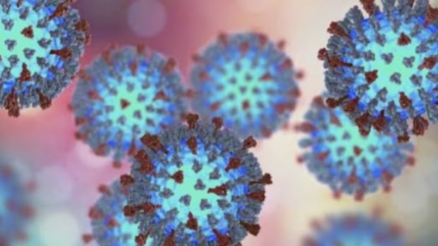 measles-outbreak-in-northern-nova-scotia-declared-over