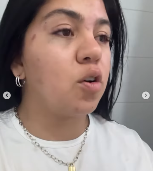 indignacion-en-redes:-brutal-agresion-xenofoba-a-familia-venezolana-en-mercado-chileno-reaviva-el-debate-migratorio