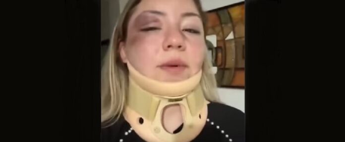 “me-sometieron-a-golpes”:-joven-denuncia-agresion-de-buhoneros-en-catia