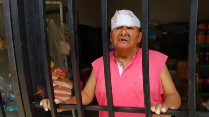 hombre-de-la-tera-edad-es-atacado-a-martillazo-por-un-ladron