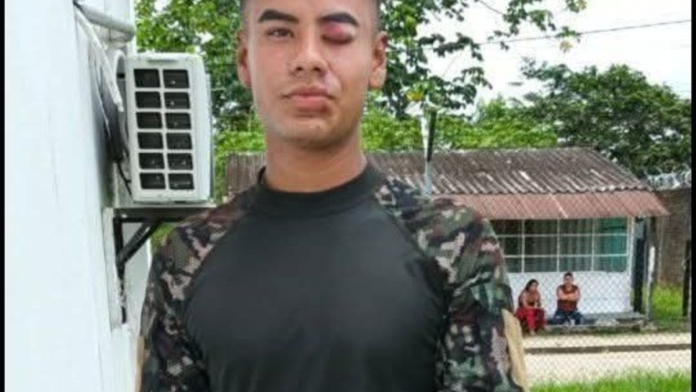 ‘mama,-se-cayo-el-avion,-pero-tranquila,-estoy-bien’:-el-desgarrador-testimonio-de-uno-de-los-57-sobrevivientes-del-accidente-del-hercules-en-putumayo