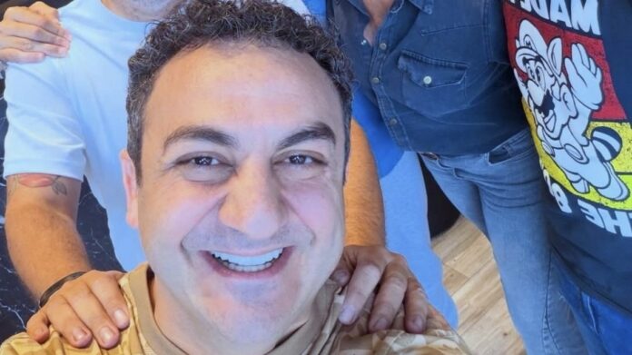 diego-topa-se-hizo-un-retoque-estetico-en-la-cara-y-causo-impacto