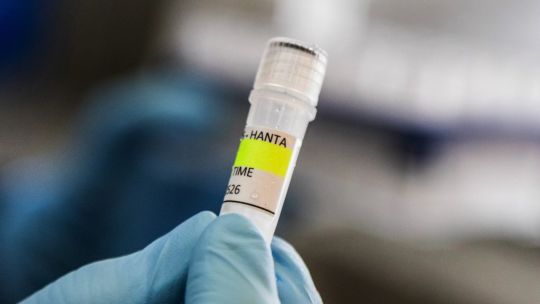 organismo-sanitario-investiga-el-hantavirus-afectado-por-nuevos-recortes-presupuestarios-de-milei