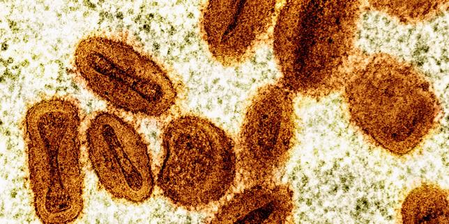 dos-virologos-inculpados-en-estados-unidos-para-intentar-importar-el-virus-de-la-viruela-simica-en-africa