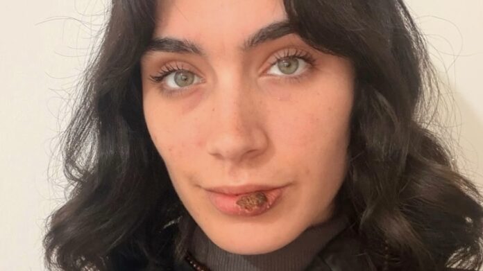 famosa-influencer-conto-que-le-detecto-sifilis-y-reactivo-la-alerta