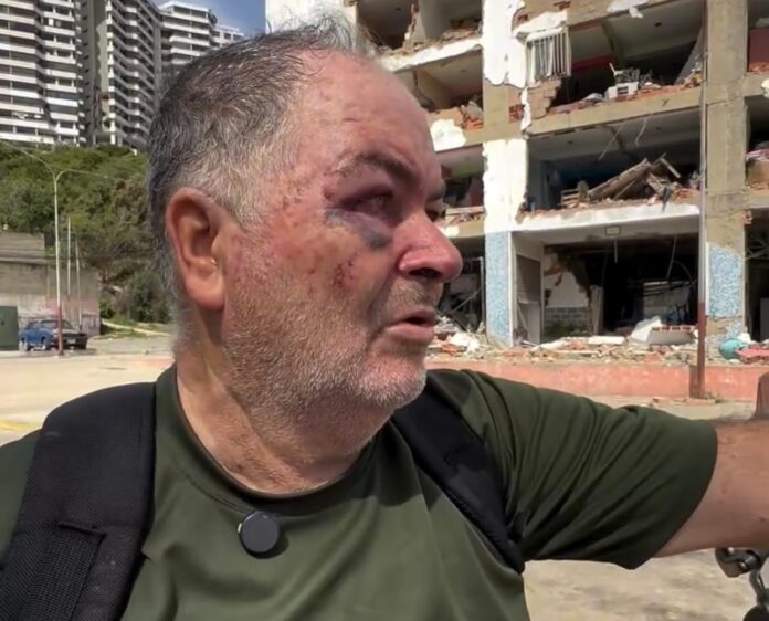 un-padre-busca-a-su-hija-trasladada-en-ambulancia-tras-ser-rescatada-de-los-escombros-en-la-guaira